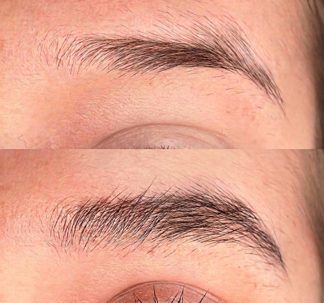 Resultado real de estímulo de fios adormecidos da sobrancelha após o protocolo Essence Brow.